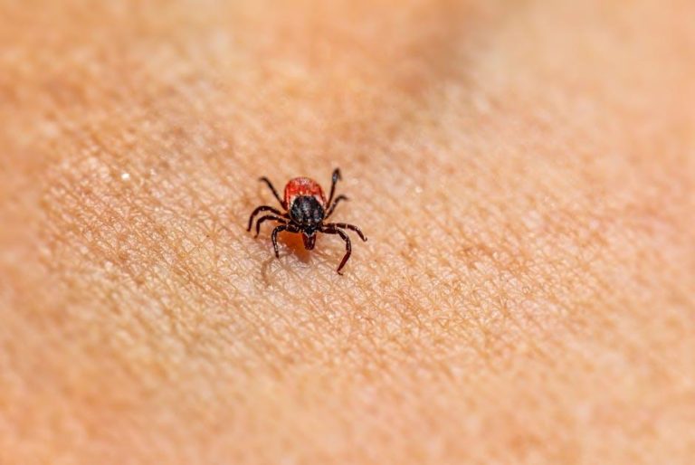 How to prevent skin irritation after grooming