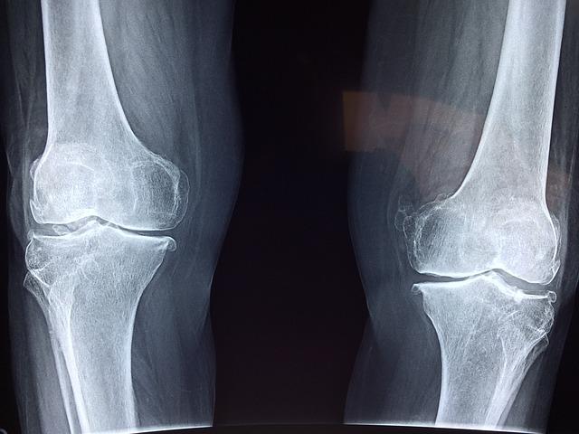 Understanding the Importance ‌of Joint Health in Dogs