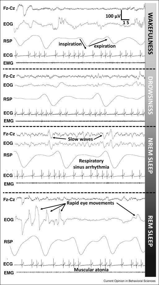 Establishing a Consistent Sleep Schedule